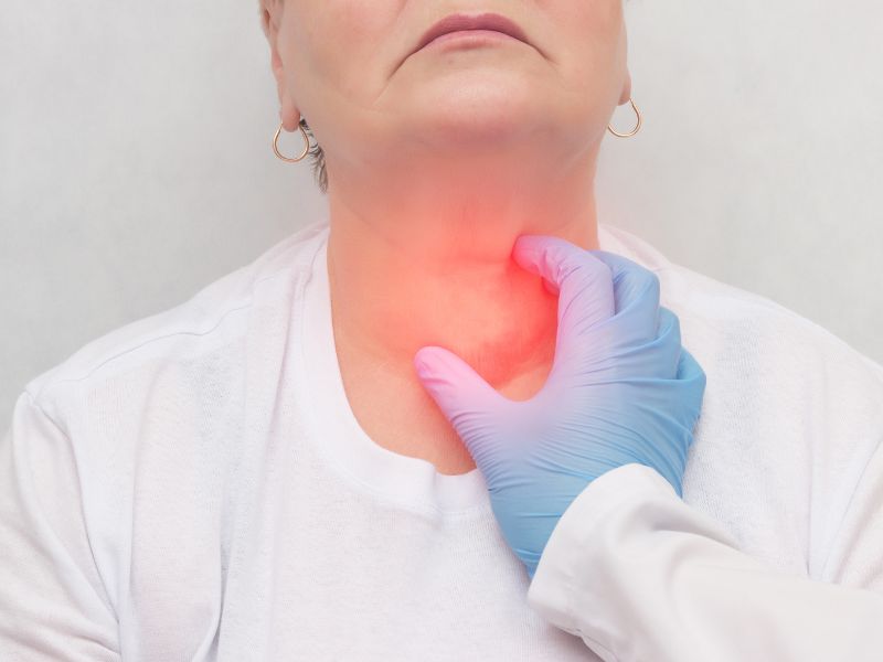 Sintomas del cáncer de tiroides 